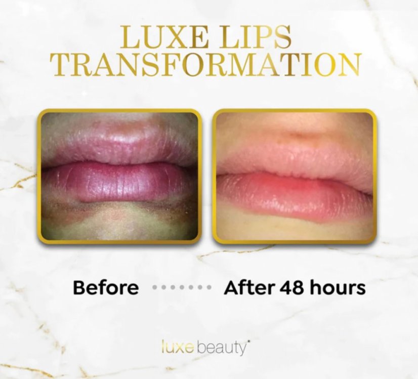 LUXE Beauty Moisturizing Beeswax-free Lip Balm 4,25g