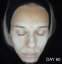 CAREIN Skin Anti Pigmentation 60 capsules exp.10/25