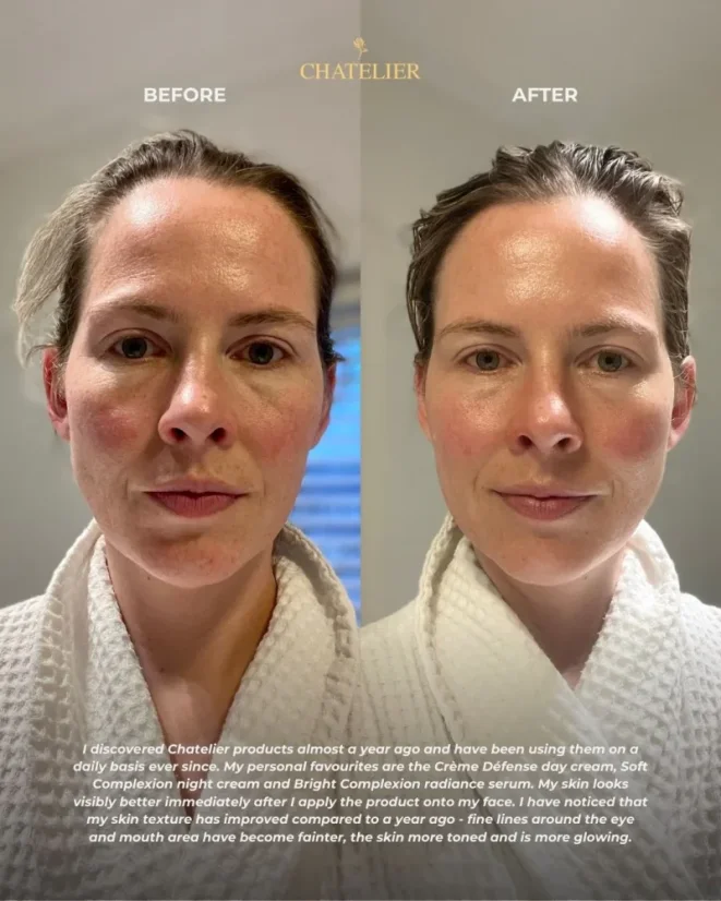 Chatelier CRÈME DÉFENSE™