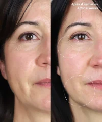 Liftující pleťová maska Le Masque Du Temps Redensifiant Absolution 50ml