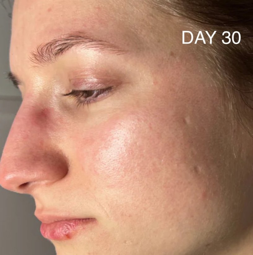 CAREIN Redness Skin 60 kapslí