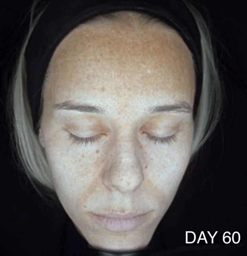 CAREIN Skin Anti Pigmentation 60 capsules exp.10/25
