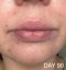 CAREIN Acne Skin 120 kapslí