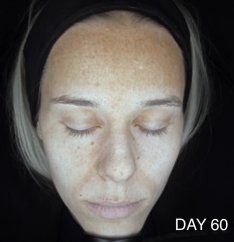CAREIN Skin Anti Pigmentation 60 capsules exp.10/25