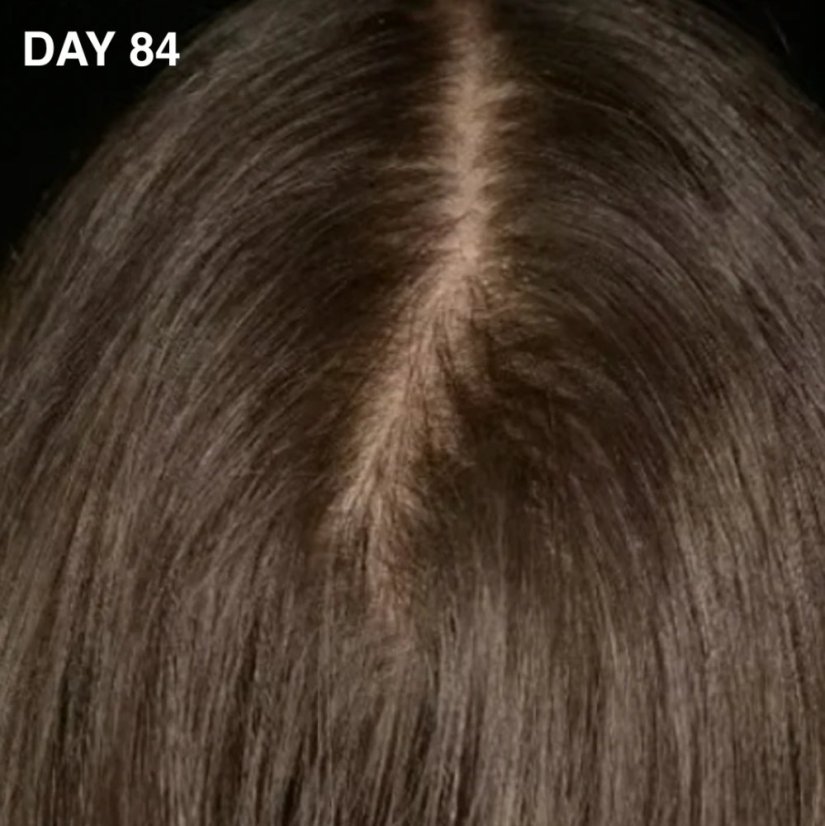 CAREIN Hair Growth Stimulator 90 capsules - Balení: refill