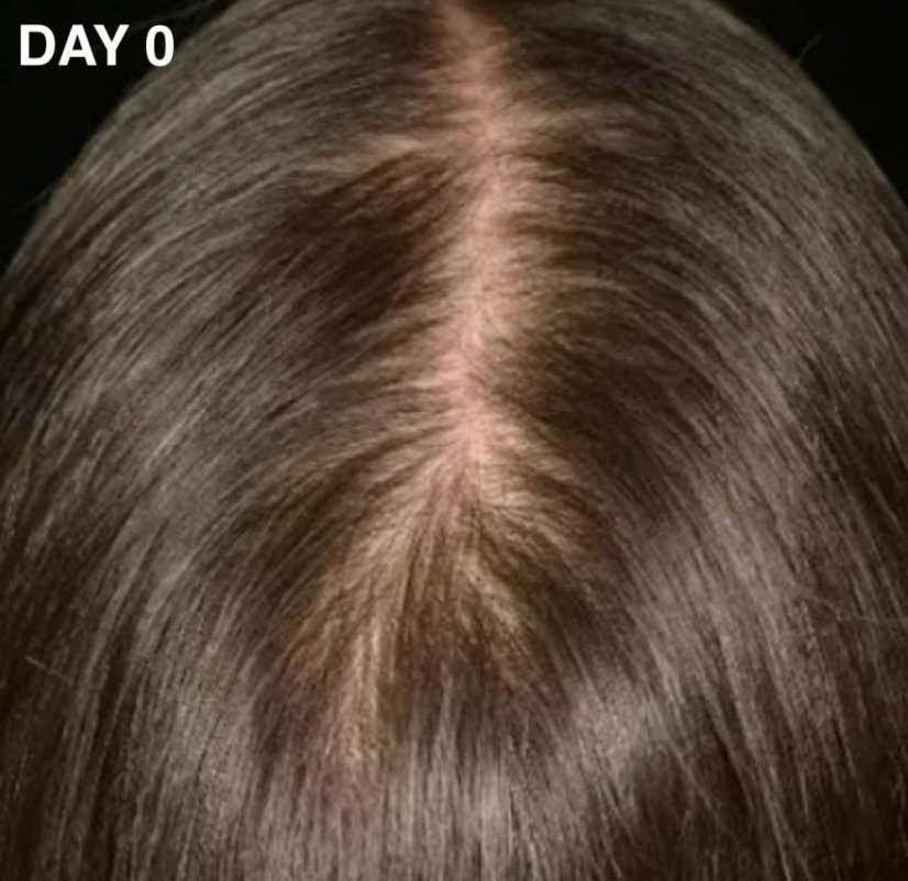 CAREIN Hair Growth Stimulator 90 capsules - Balení: refill