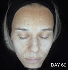 CAREIN Skin Anti Pigmentation 60 capsules exp.10/25