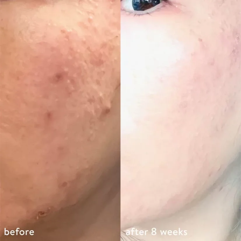 LUMION Miracle Mist mlha na pleť