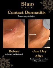 Siam SEAS the Guardian – Mother of All Serums 30ml