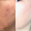 LUMION Miracle Mist mlha na pleť
